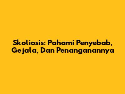 Skoliosis: Pahami Penyebab, Gejala, Dan Penanganannya