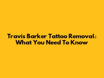 Travis Barker Tattoo Removal: What You Need To Know